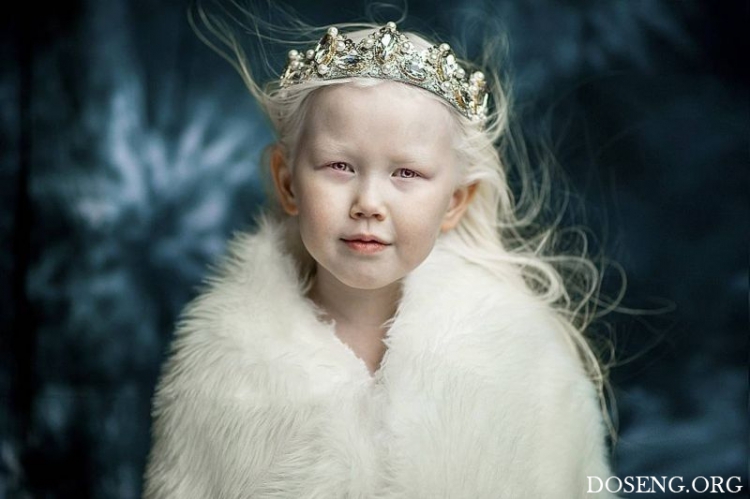 Якутскую девочку-альбиноса прозвали Снежной Королевой